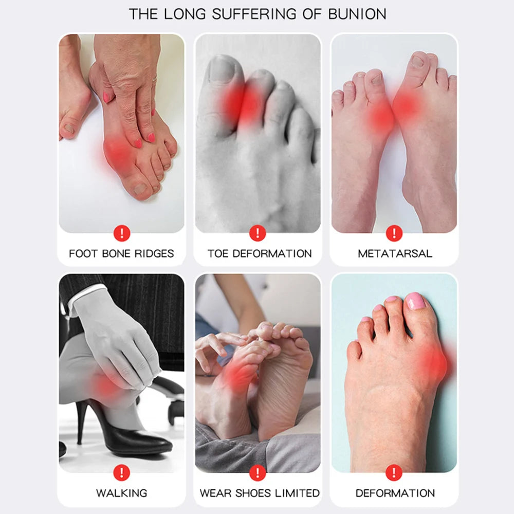 Adjustable Big Toe Bunion Corrector